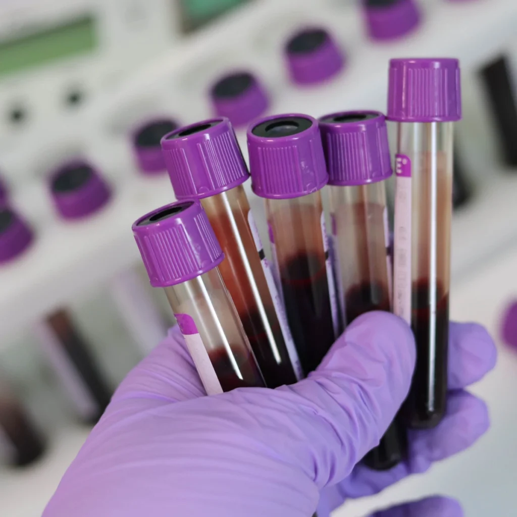 Blood Collection and Laboratory Queue Management System Solutions